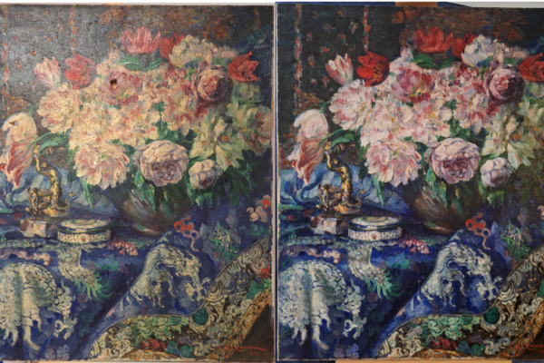restauration esthétique